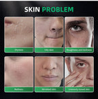 3-in-1 Skin Care Kit